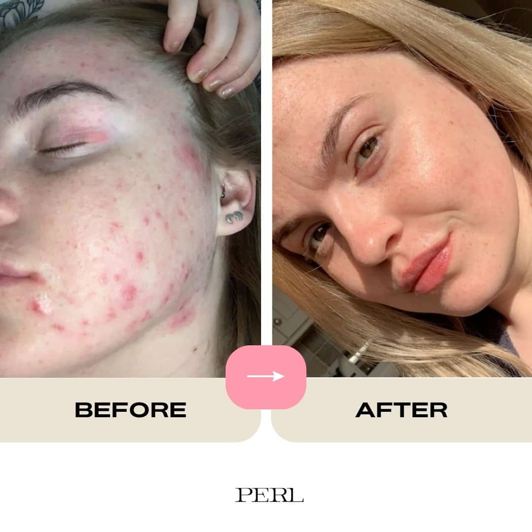 British Pink Clay Mask - Refill - PERL Cosmetics